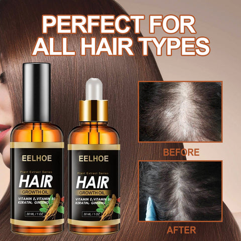 EELHOE Herb Essence Hair Hairdressing Hair Care Essential Oil Hair Strong Hair Reduce Hair Loss Broken Hair Hair Care Essential Oil